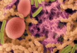 diet-con-streptococcus-mutans-1 diet-con-streptococcus-mutans